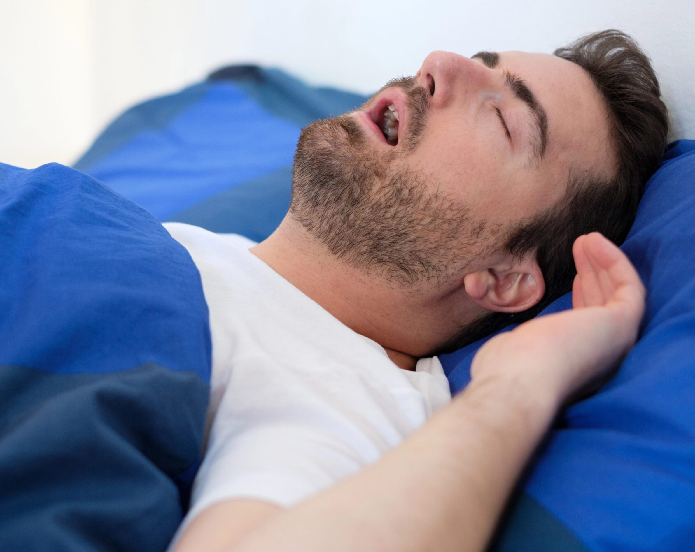 síntomas, causas, tratamiento | ¿Qué es la apnea del sueño?